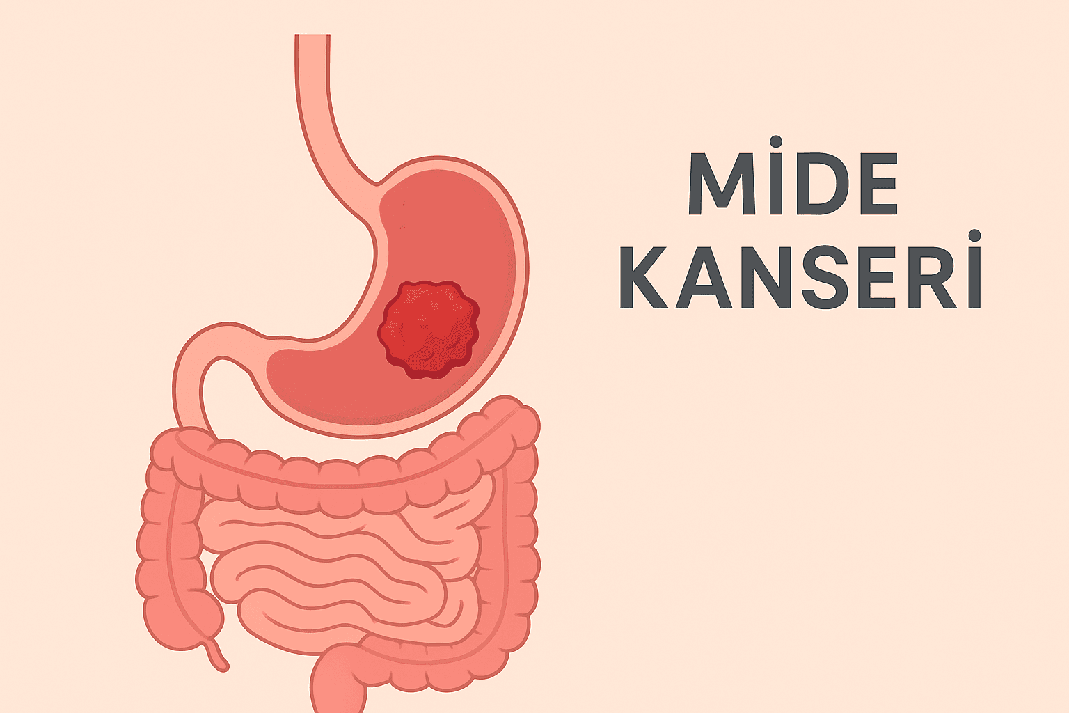 Mide Kanserinde Kemoterapi Sürecinde 10 Beslenme Önerisi